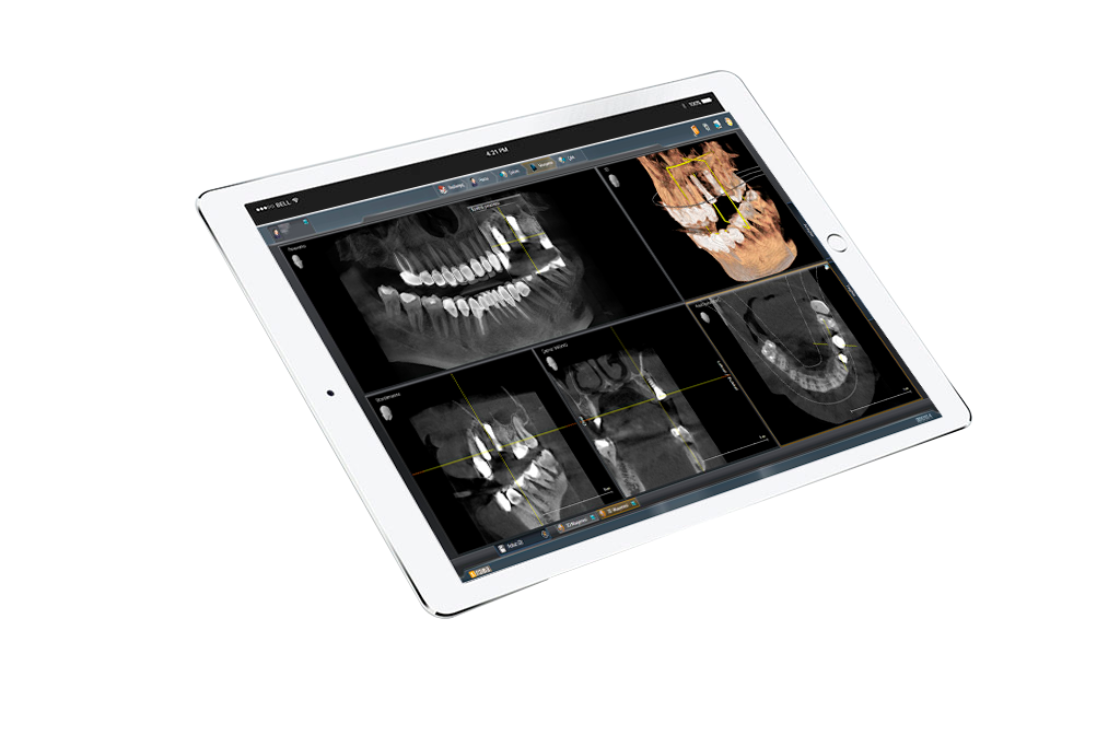 i-pad-x-ray