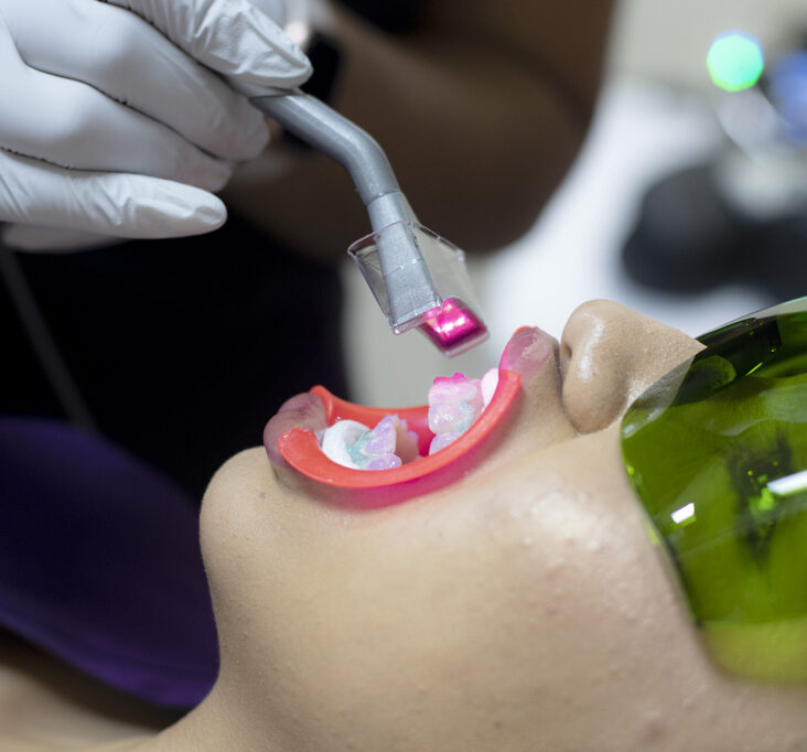 Affortable Dental Veneers Smile Dental Nogales