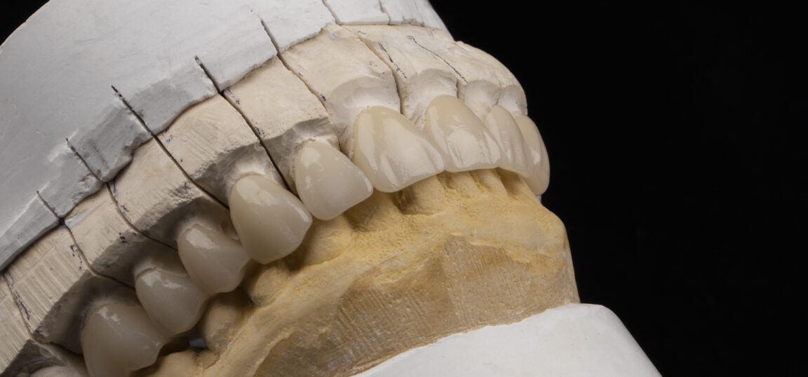 Smile Dental Nogales Dental Implants, Orthodontics & Aesthetic Clinic